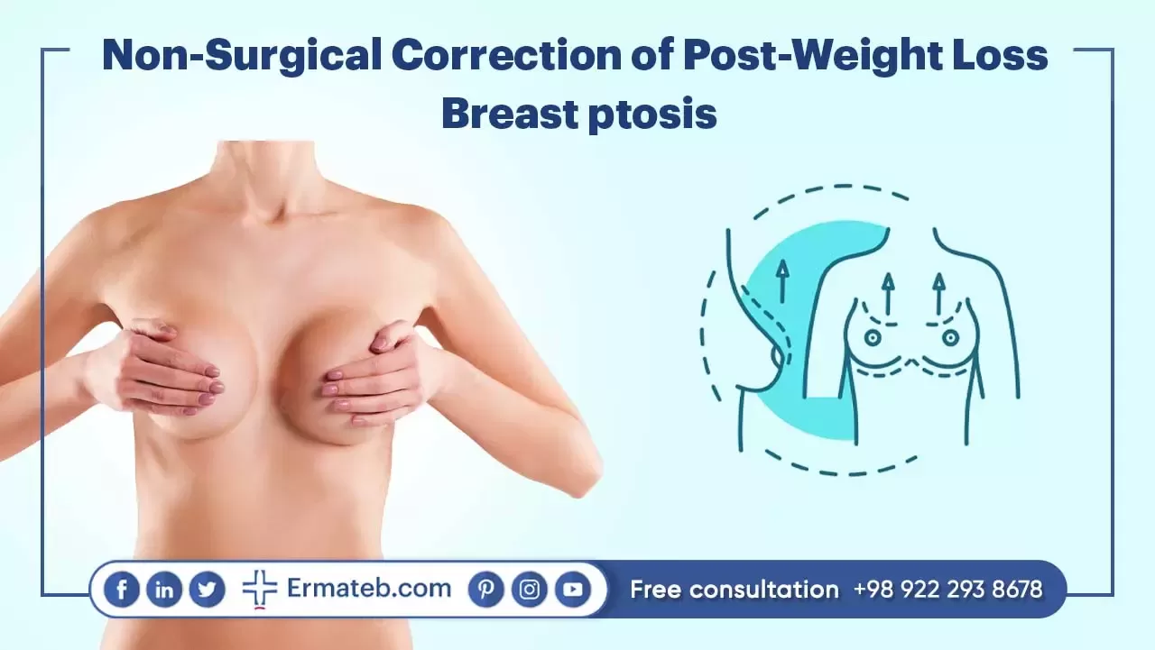 Non-Surgical Correction of Post-Weight Loss Breast ptosis