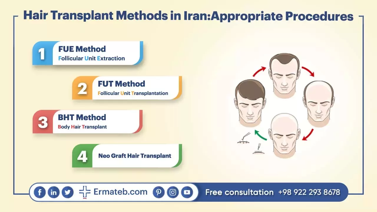 Hair Transplant Methods in Iran: Appropriate Procedures