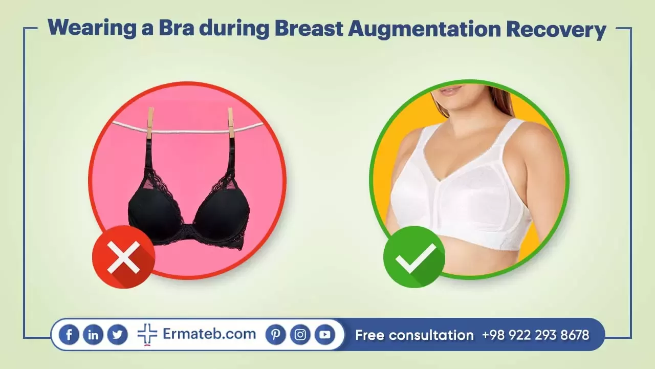 Wearing a Bra during Breast Augmentation Recovery