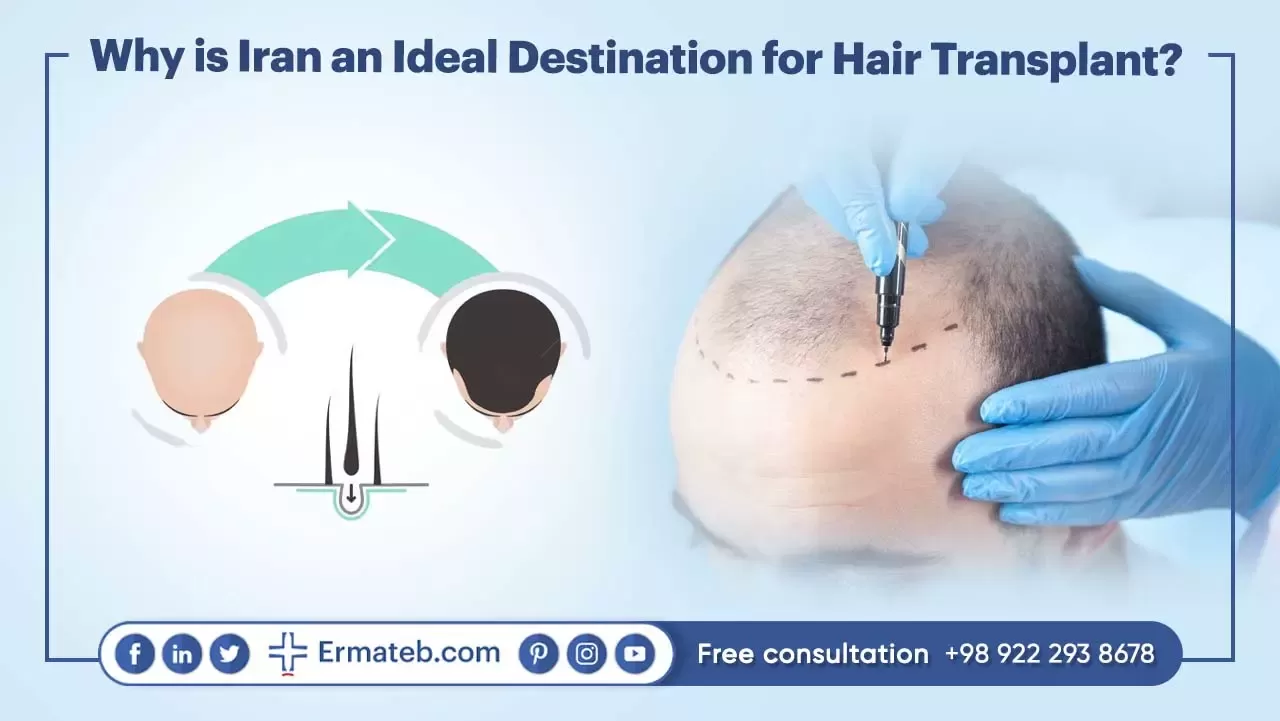 Why is Iran an Ideal Destination for Hair Transplant?