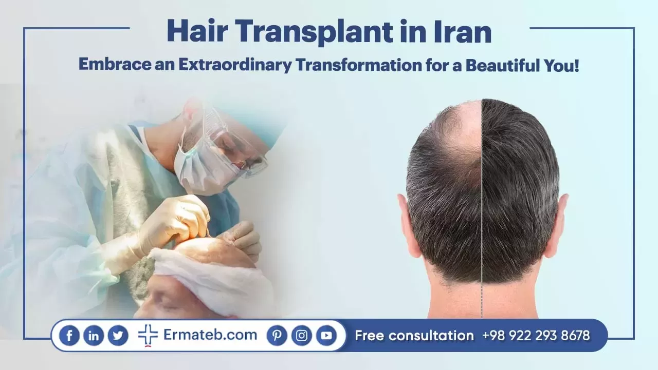 Hair Transplant in Iran: Embrace an Extraordinary Transformation for a Beautiful You!