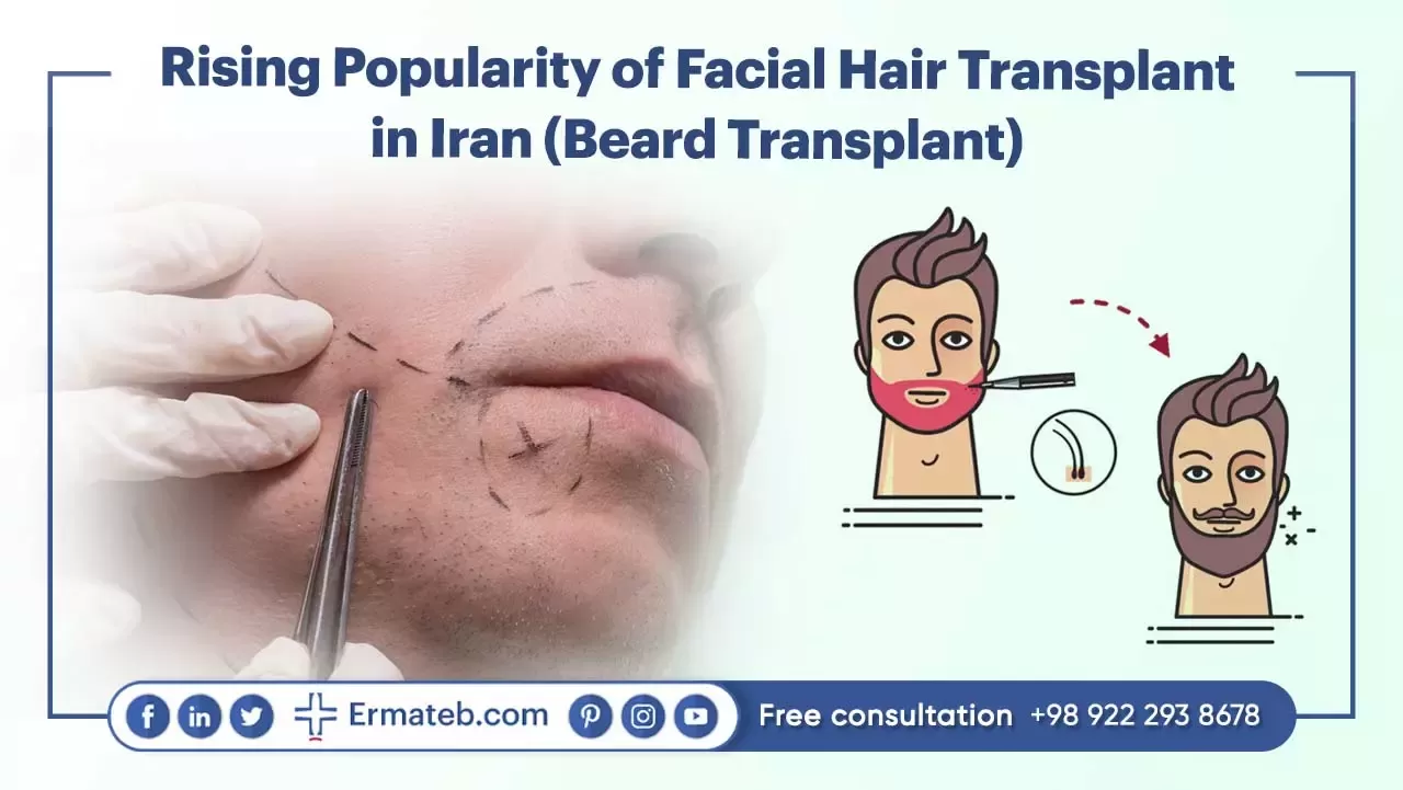 Rising Popularity of Facial Hair Transplant in Iran (Beard Transplant)