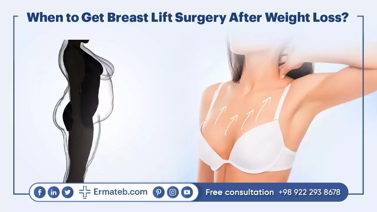 When to Get Breast Lift Surgery After Weight Loss?