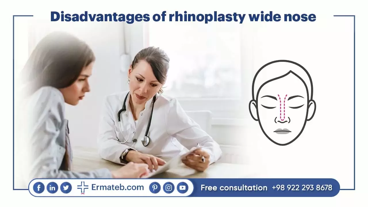 Disadvantages of rhinoplasty wide nose