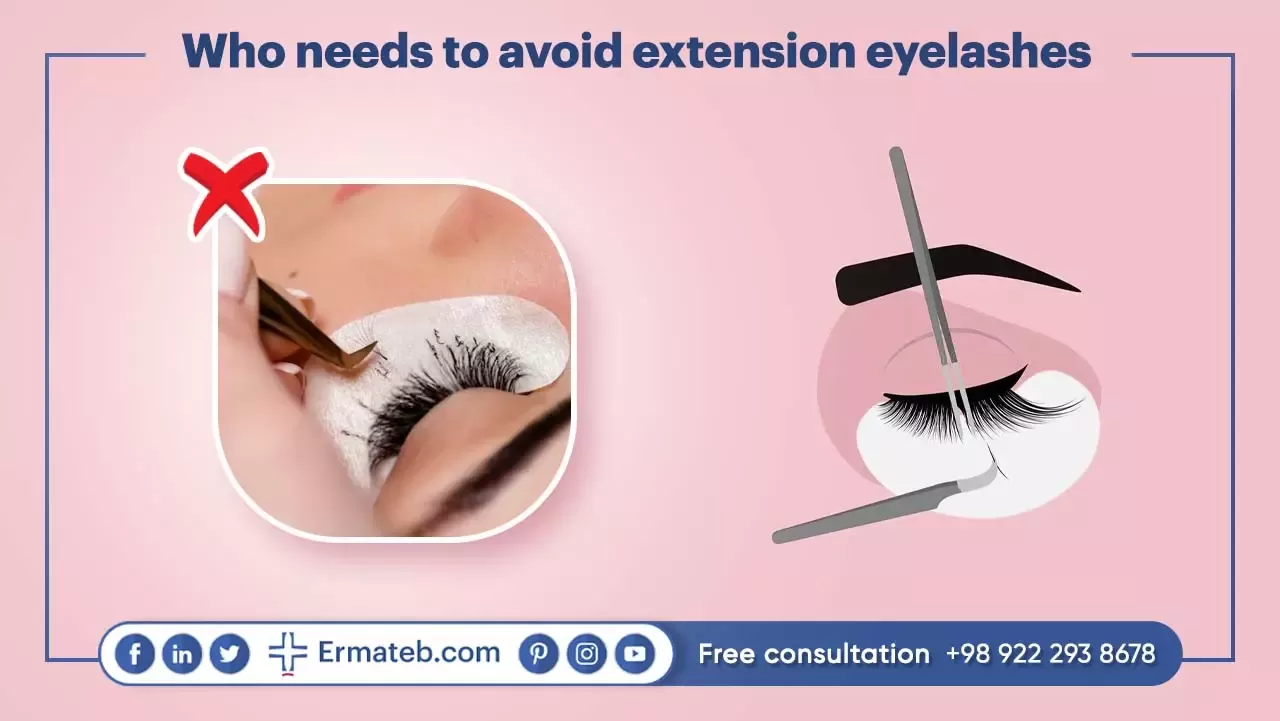 Who needs to avoid extension eyelashes
