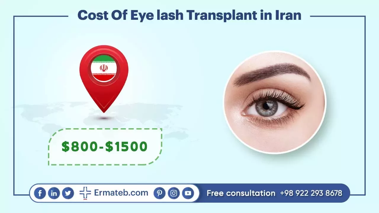 Cost Of Eye lash Transplant in Iran