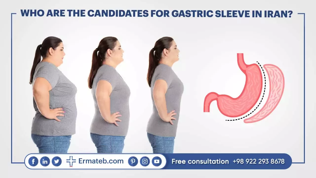WHO ARE THE CANDIDATES FOR GASTRIC SLEEVE IN IRAN?