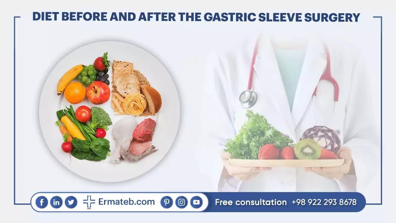 DIET BEFORE AND AFTER THE GASTRIC SLEEVE SURGERY 