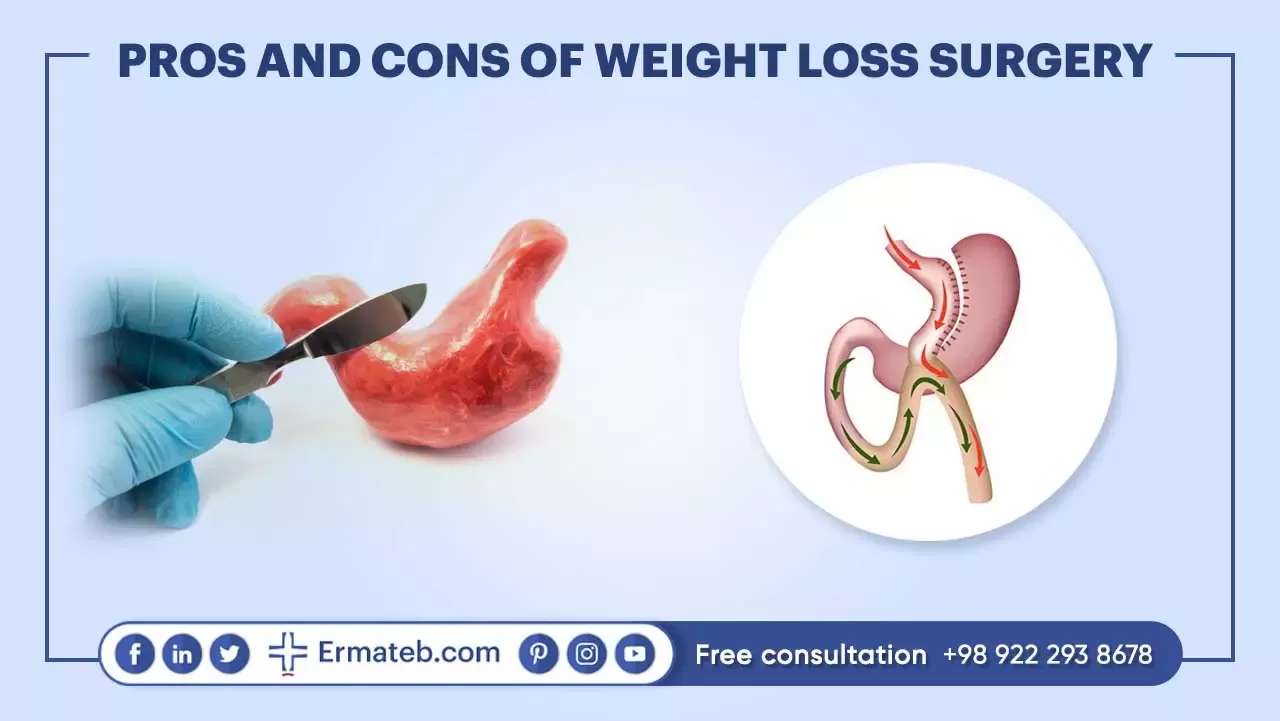 PROS AND CONS OF WEIGHT LOSS SURGERY
