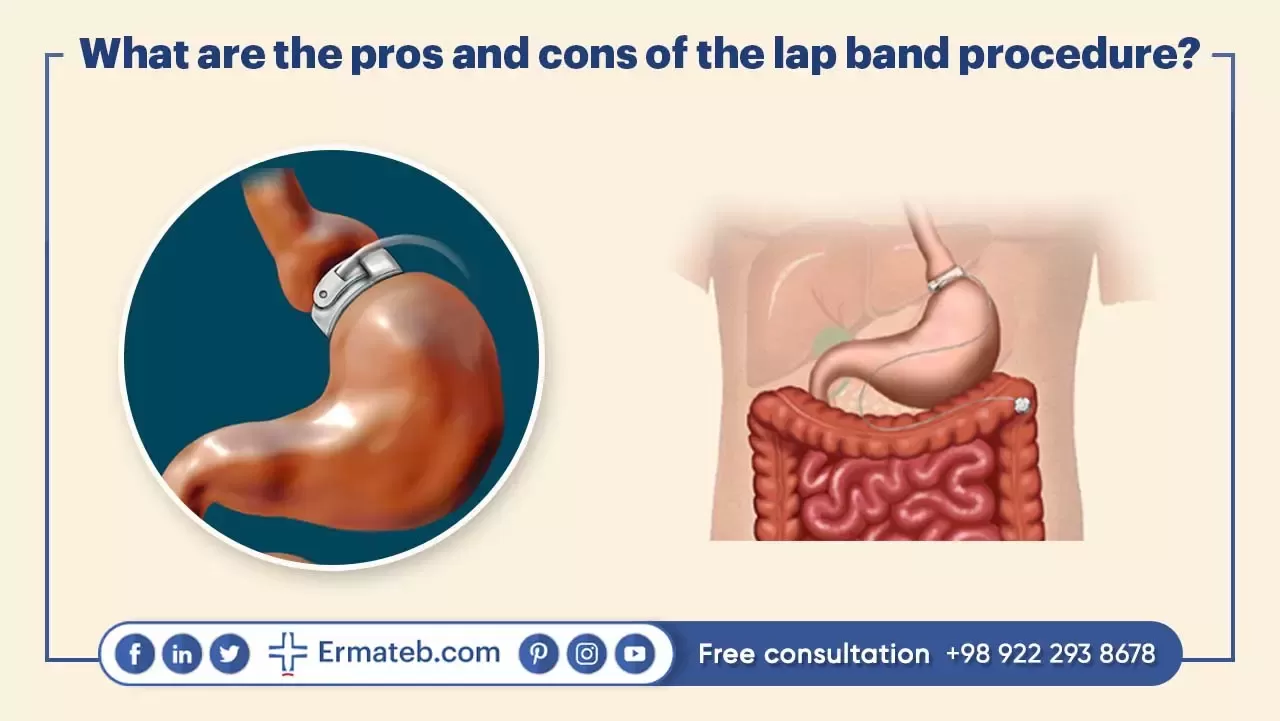 What are the pros and cons of the lap band procedure?