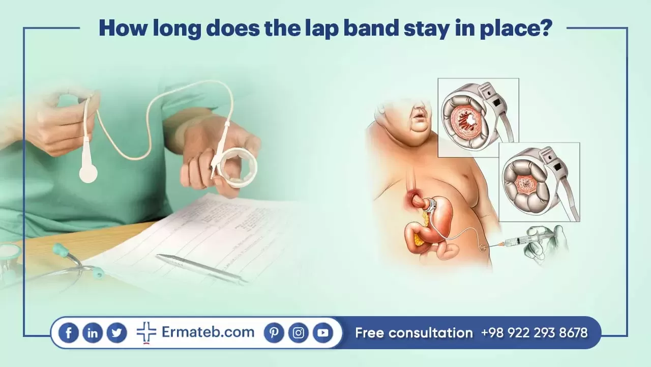 How long does the lap band stay in place?