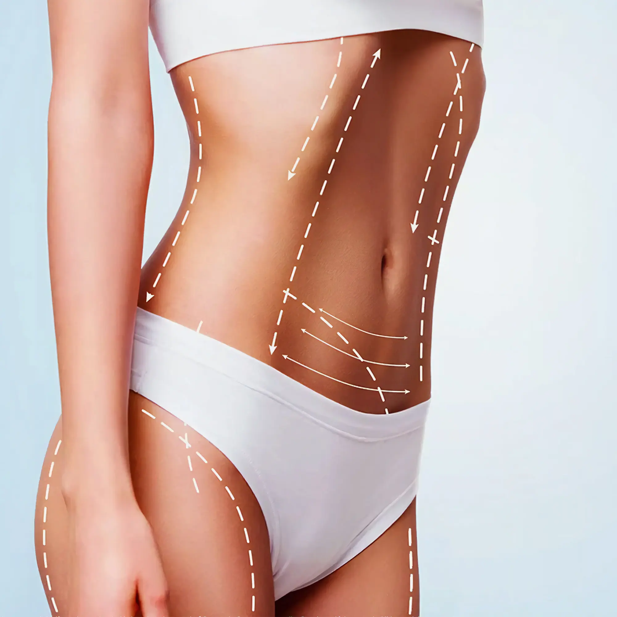Liposuction In Iran