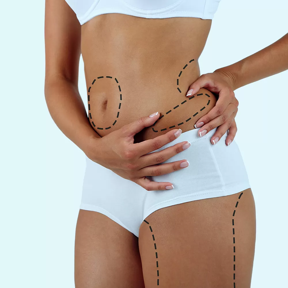 Lipomatic surgery in Iran