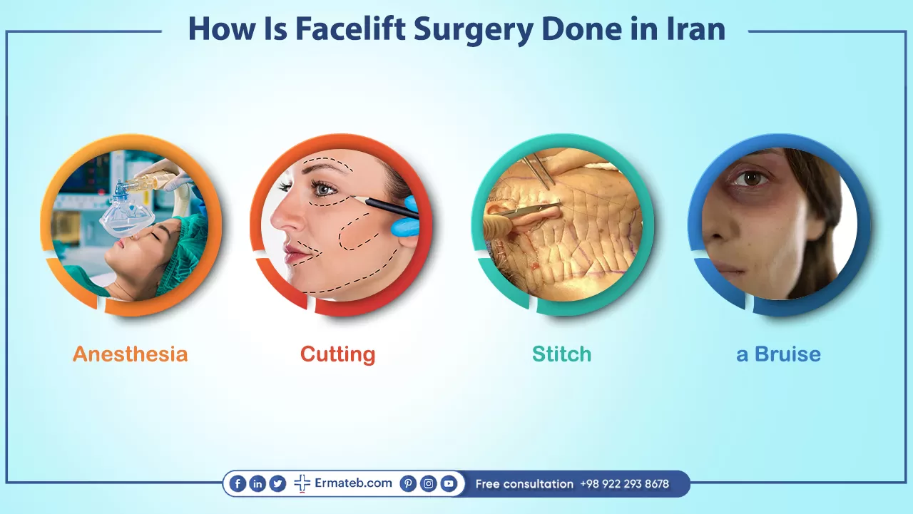 How Is Facelift Surgery Done in Iran?