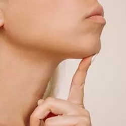 Genioplasty in Iran