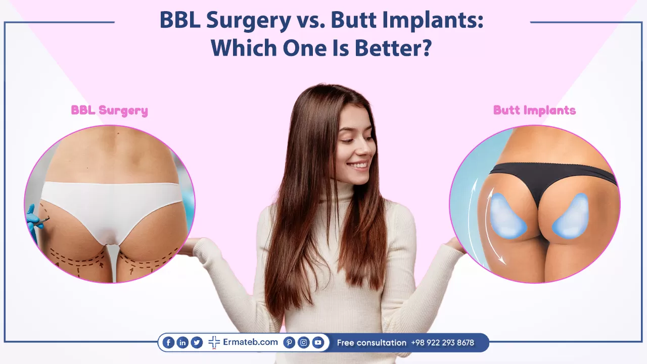 BBL Surgery vs. Butt Implants:  Which One Is Better?