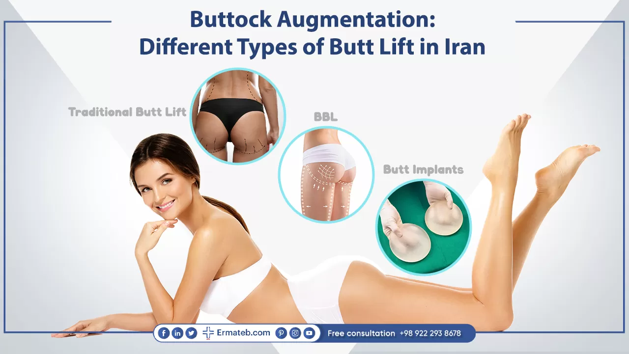 Buttock Augmentation: Different Types of Butt Lift in Iran