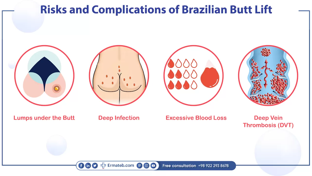Risks and Complications of Brazilian Butt Lift