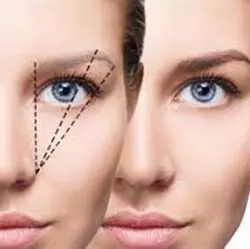 Eyebrow Transplantation in Iran
