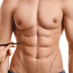 Abdominal Etching in Iran