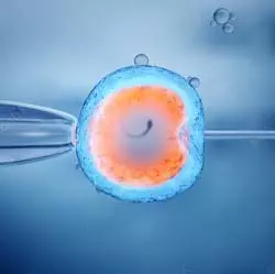 In Vitro Fertilization (IVF) in Iran