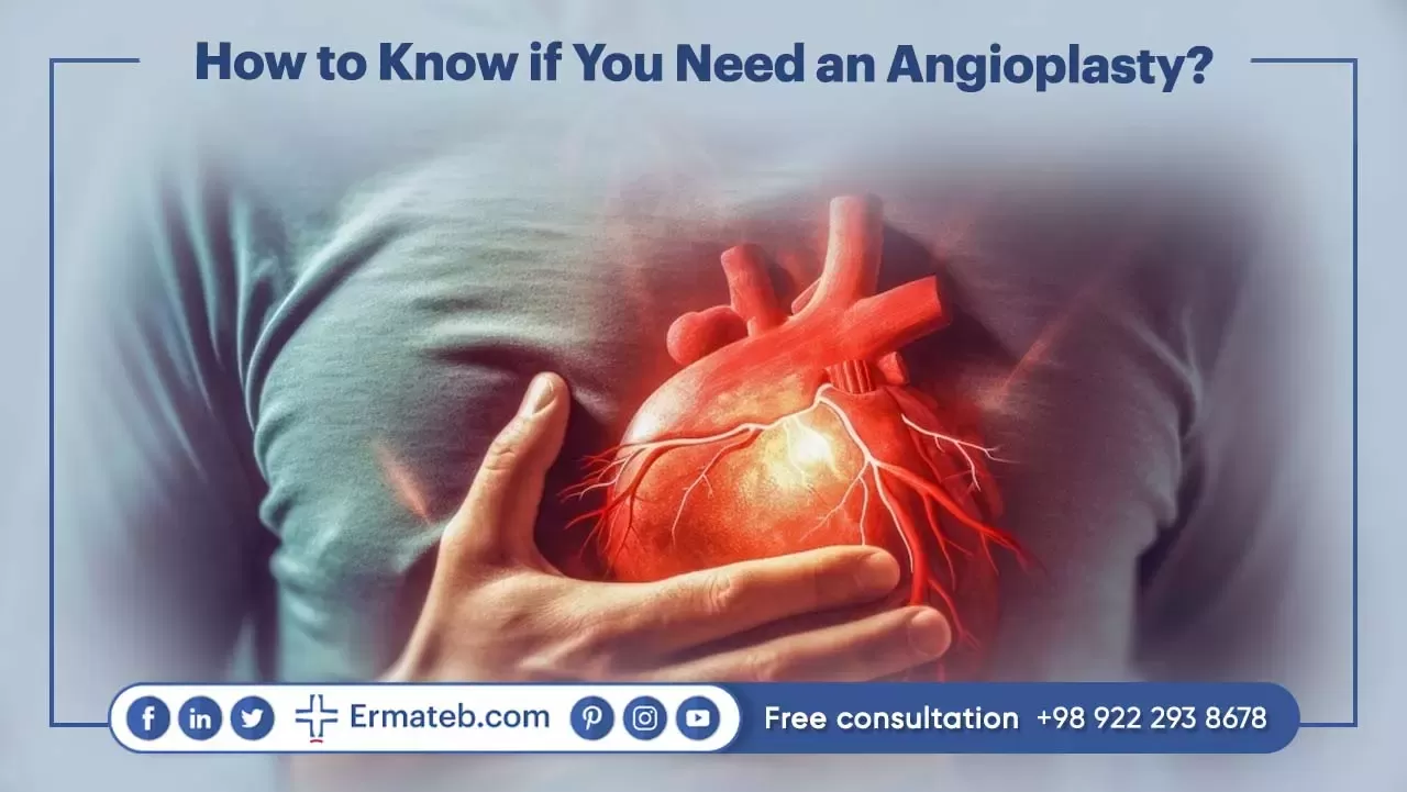How to Know if You Need an Angioplasty?