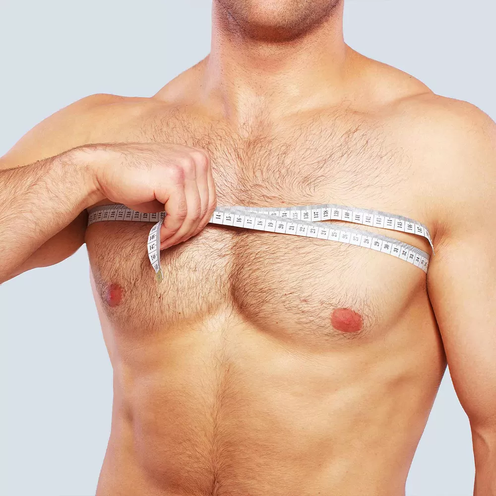 Gynecomastia Surgery in Iran