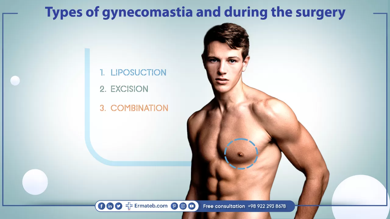 Types of gynecomastia and during the surgery