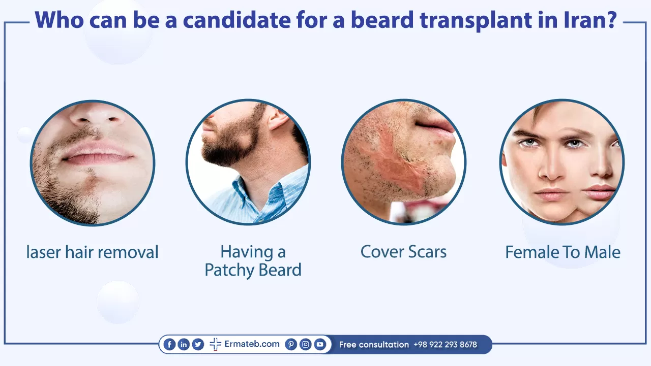 Who can be a candidate for a beard transplant in Iran?