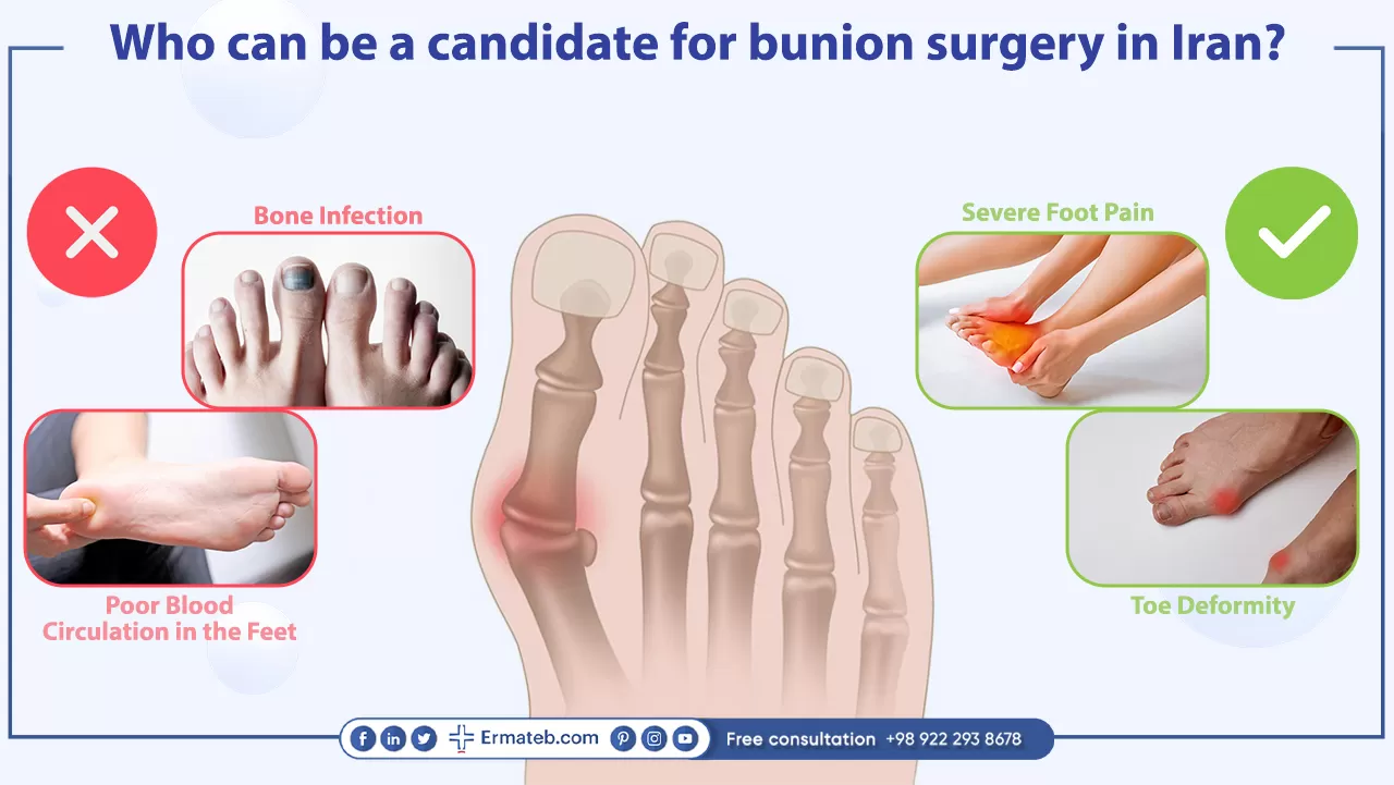 Who can be a candidate for bunion surgery in Iran?