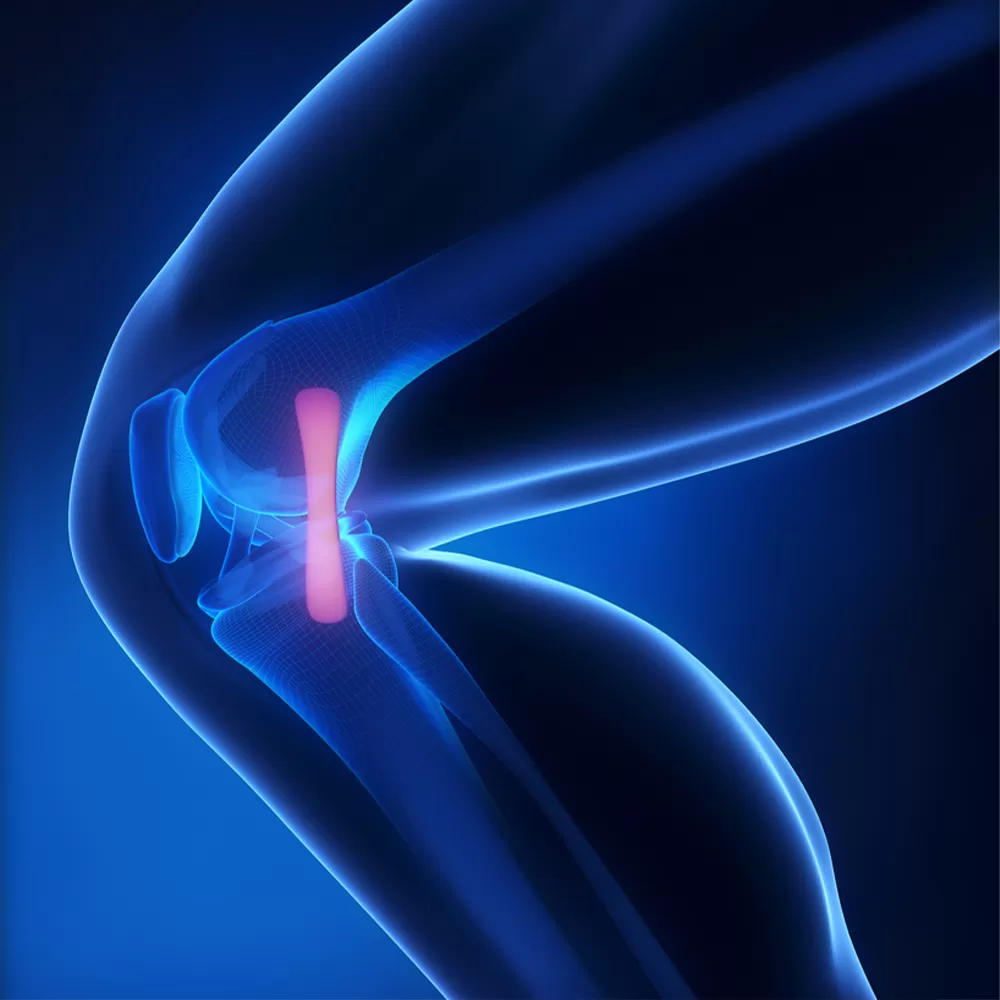 ACL and PCL Surgery in Iran