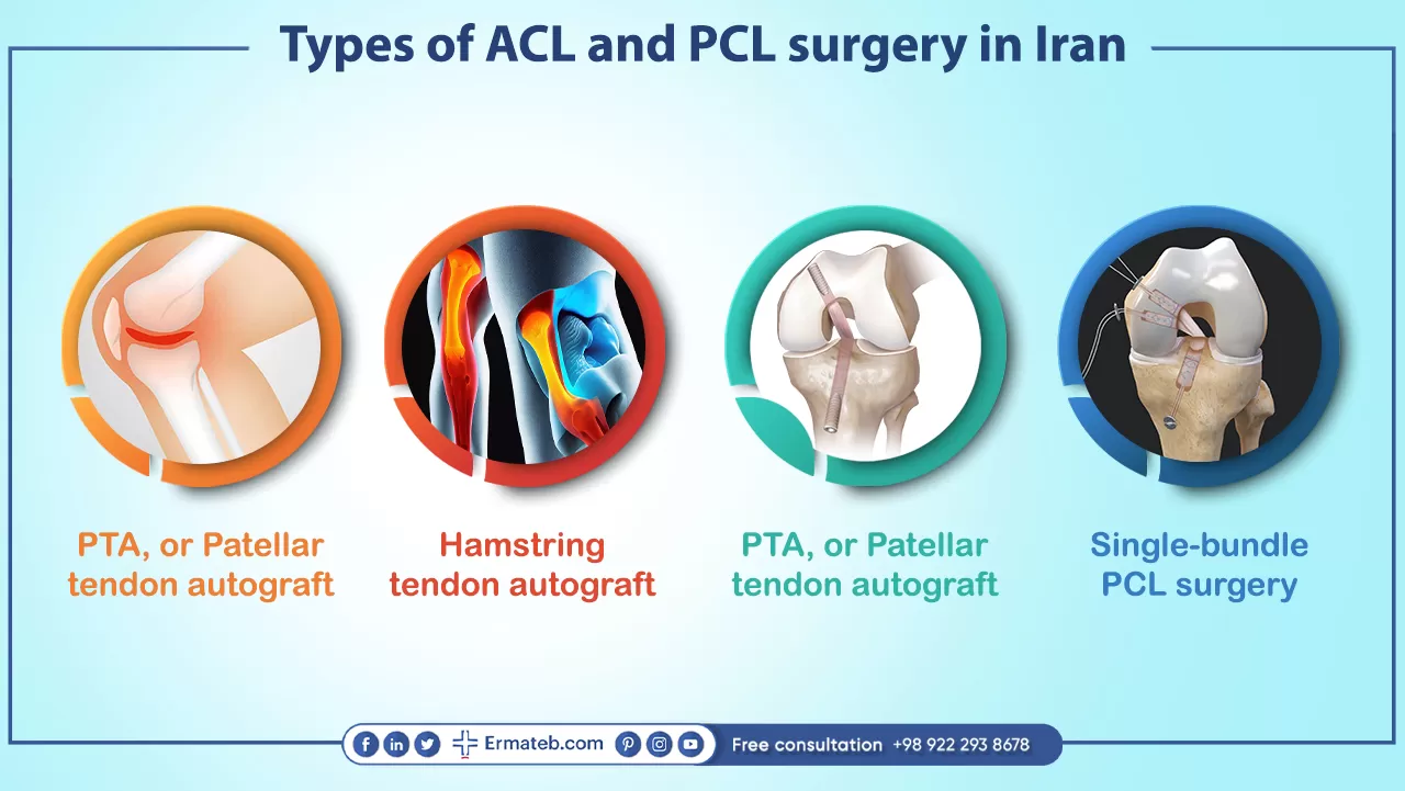 Types of ACL and PCL surgery in Iran