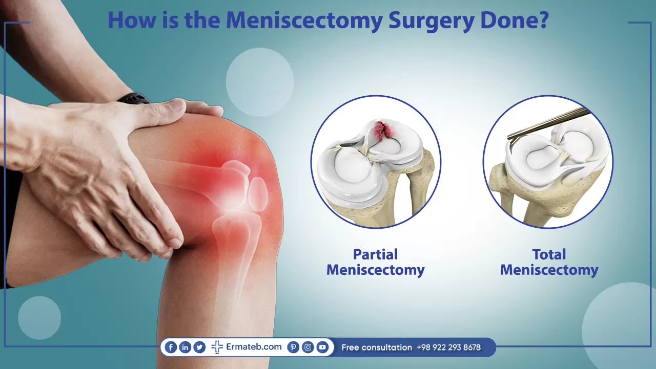 How is the meniscectomy surgery done?