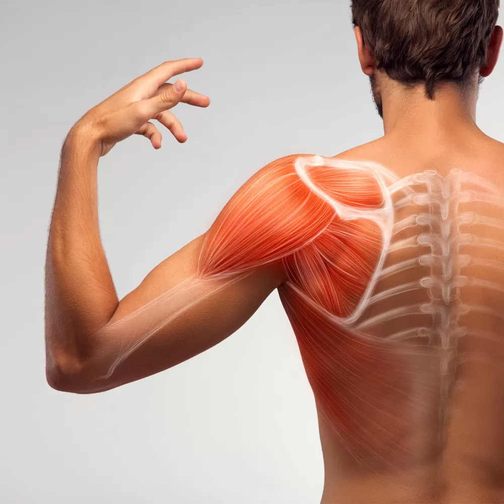 Frozen shoulder treatment in Iran
