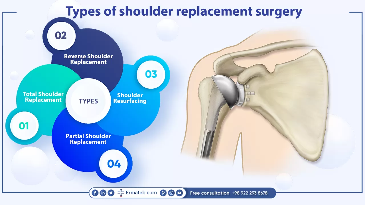 Types of shoulder replacement surgery 