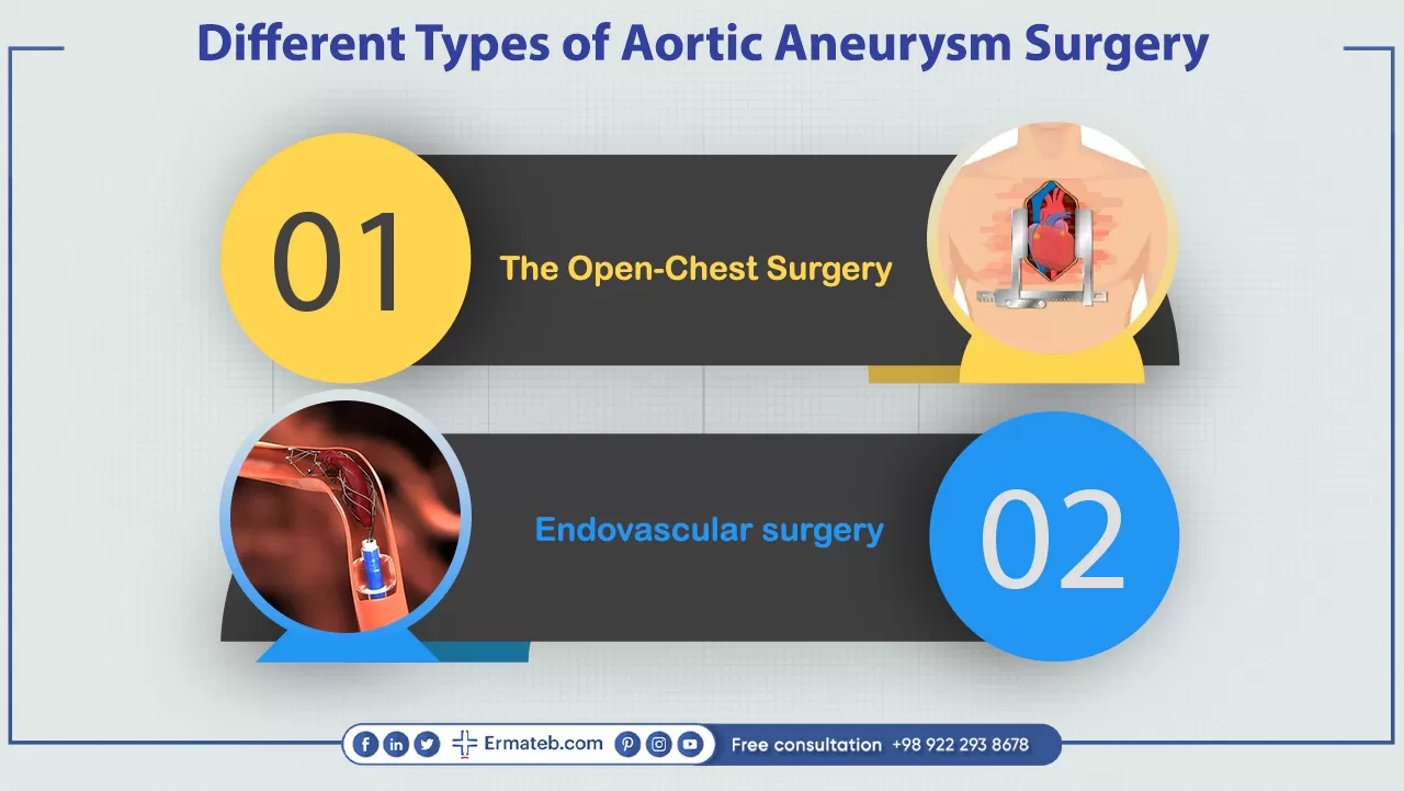 Different Types of Aortic Aneurysm Surgery