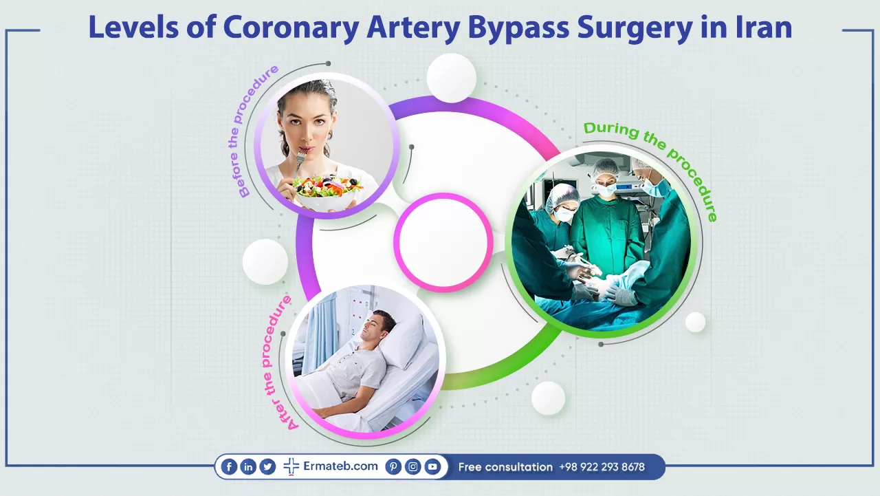 Levels of Coronary Artery Bypass Surgery in Iran