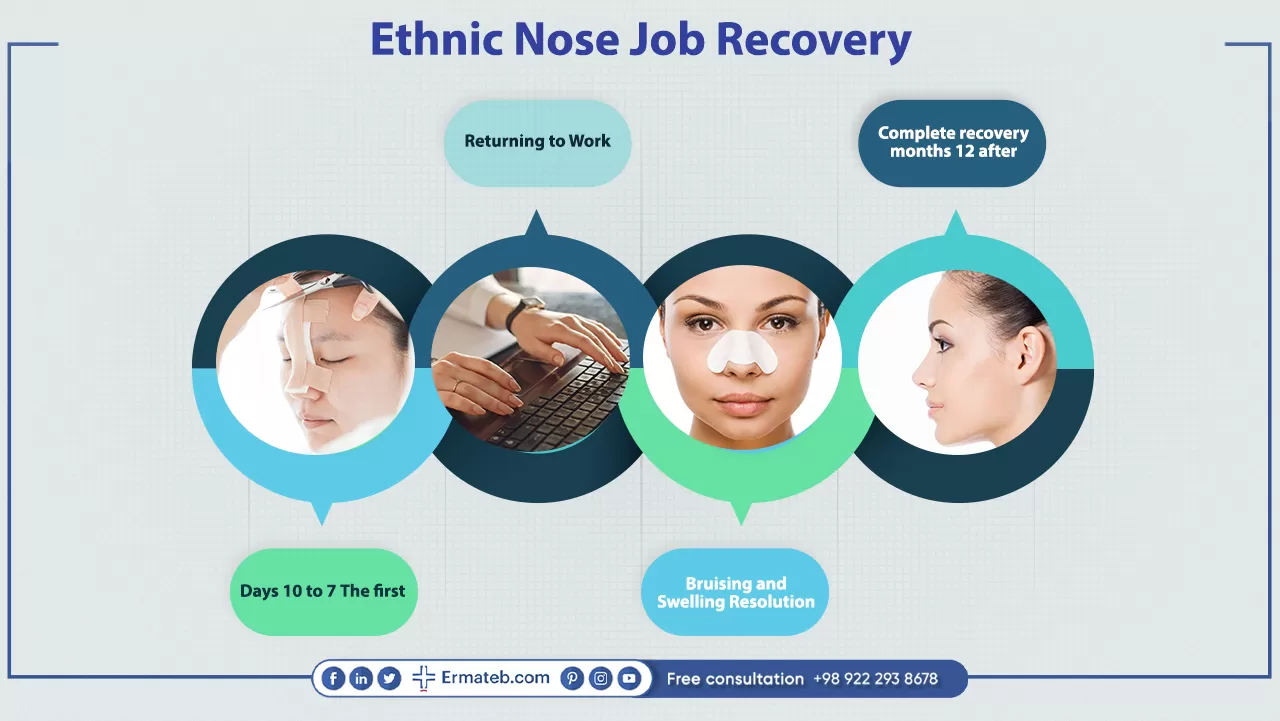 Ethnic Nose Job Recovery