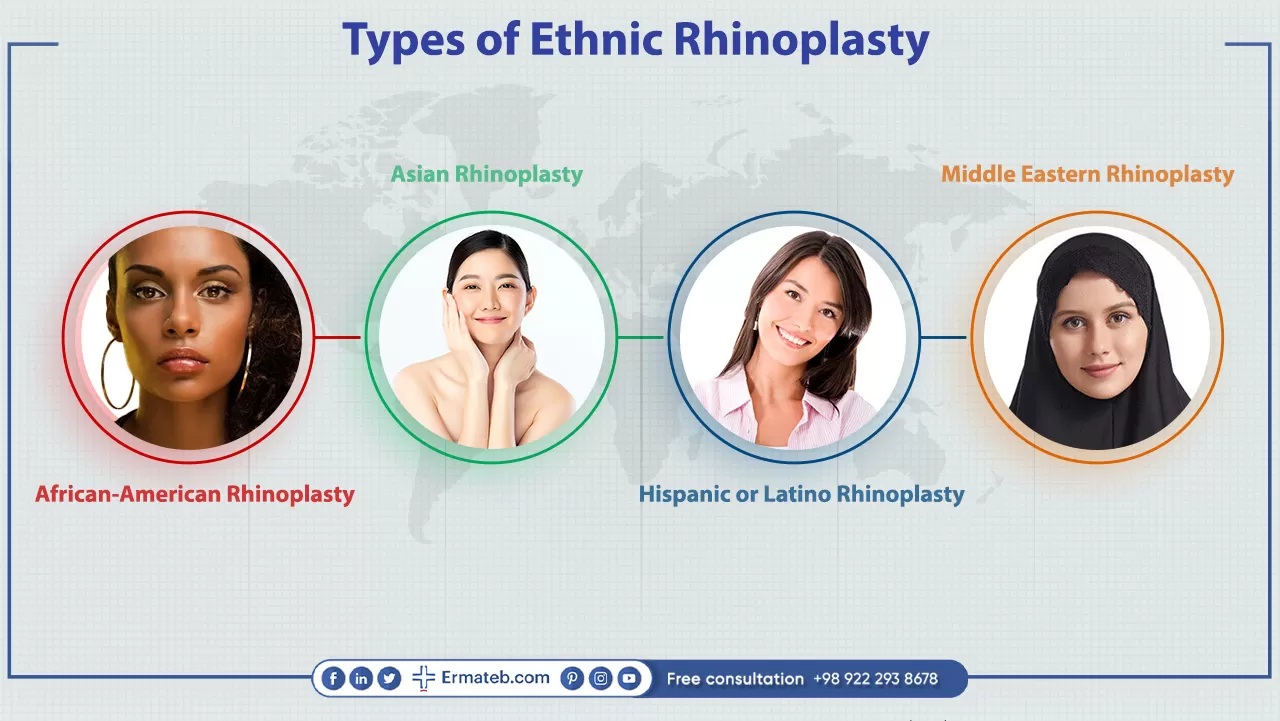 types of ethnic nose jobs in Iran contations: Middle Eastern Rhinoplasty in Iran, African-American Rhinoplasty,Hispanic or Latino Rhinoplasty, Asian Rhinoplasty