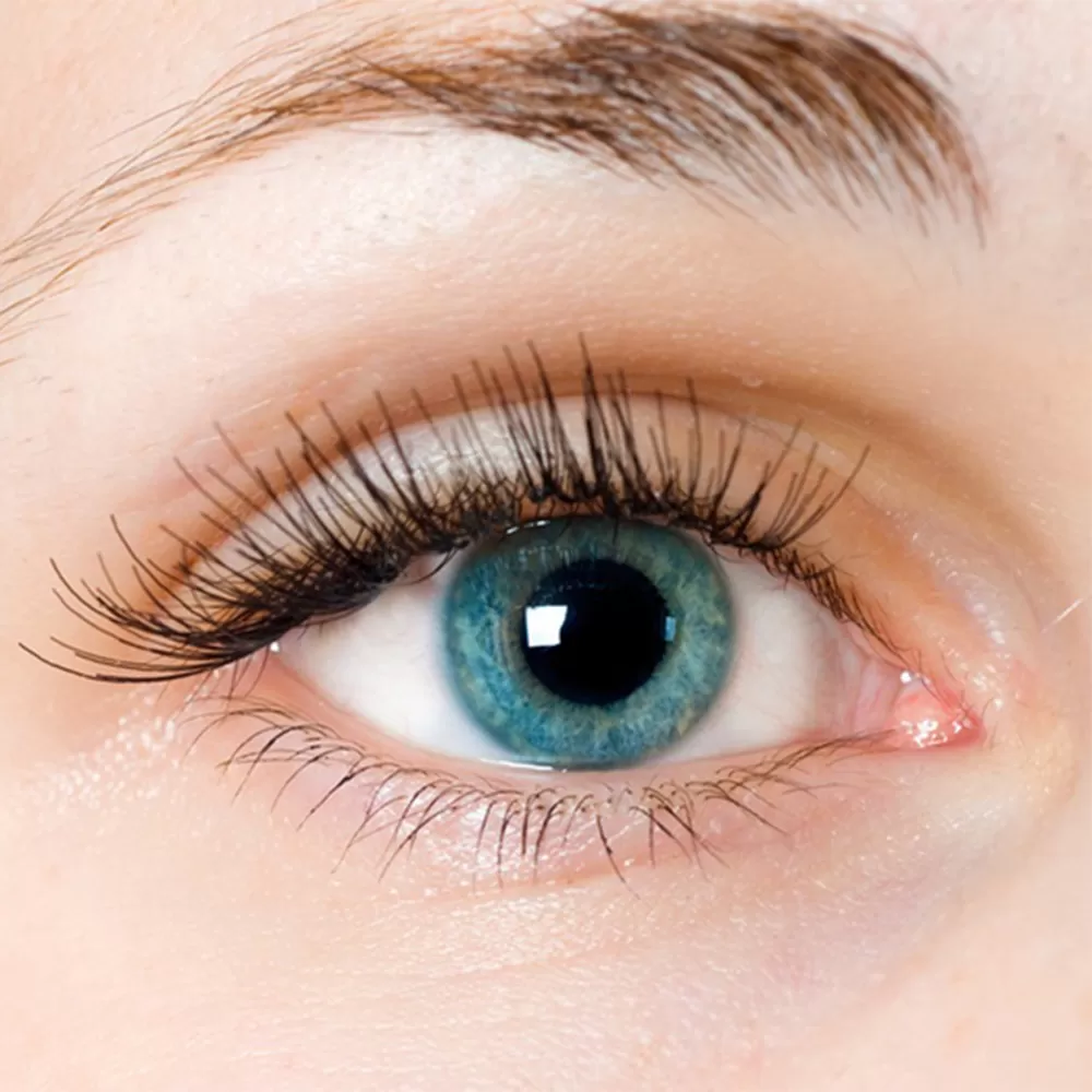 PRK Eye Surgery in Iran