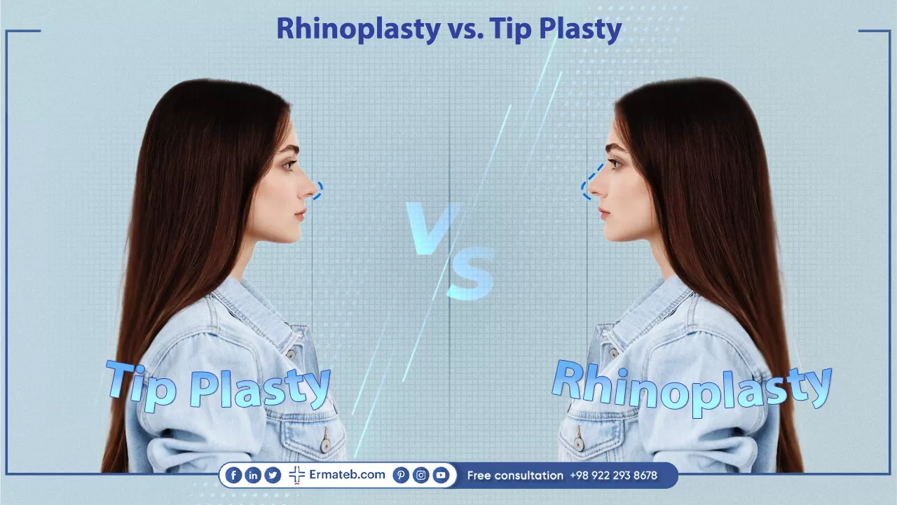 Rhinoplasty vs. Tip Plasty 