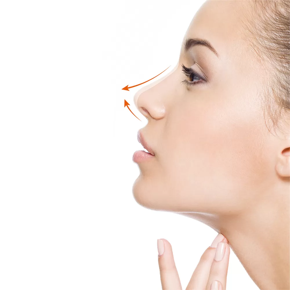 Tip Plasty in Iran