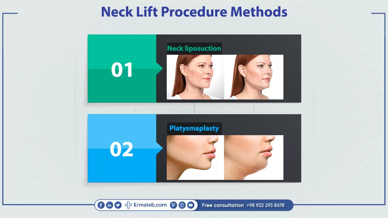 Neck Lift Procedure Methods and Options